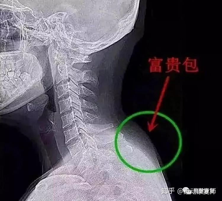v2-635a9c68f781b1762837711cba3c1166_r.jpg