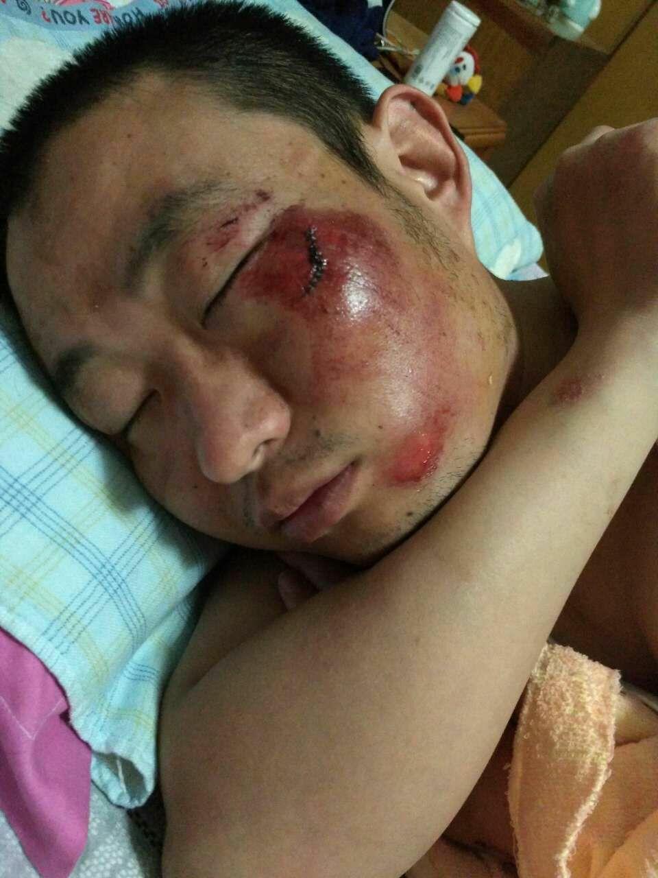 骑行摔车是什么样的体验?