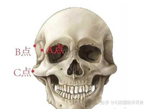 颧骨颧弓究竟选填充太阳穴还是颧骨内推