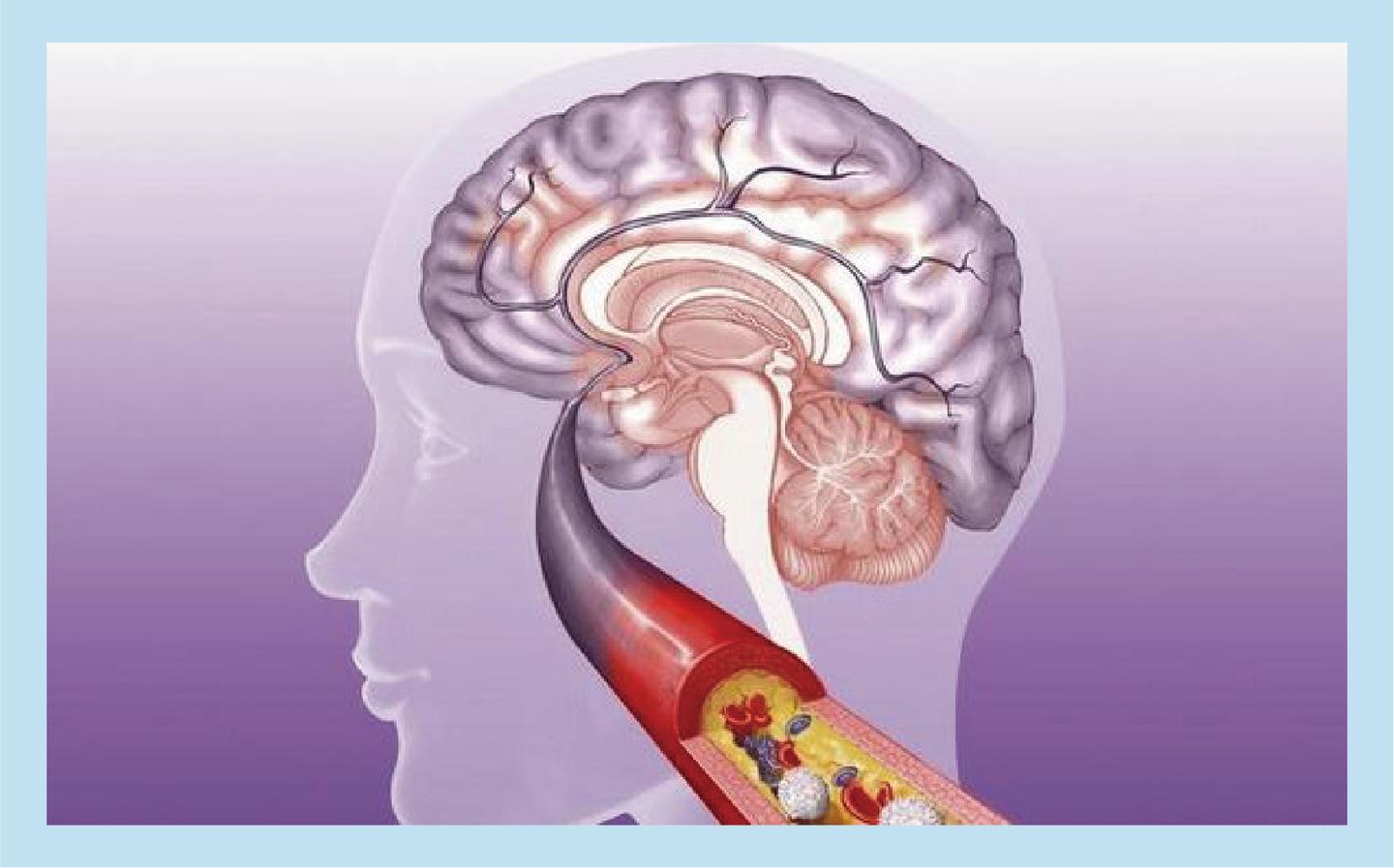 v2-63791afbba77a31a8ff0cc16f72ecc60_1440w.jpg?source=172ae18b