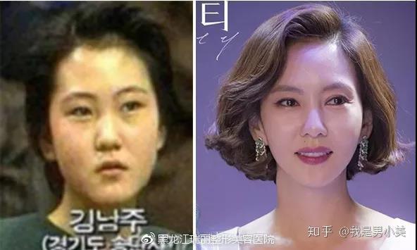 因为不够完美 所以才要穿对 知乎