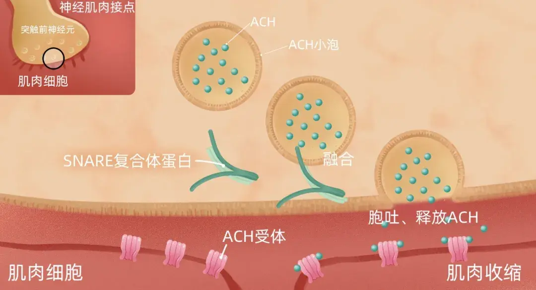 肉毒梭菌肉身弱爆法力无边的伏地魔