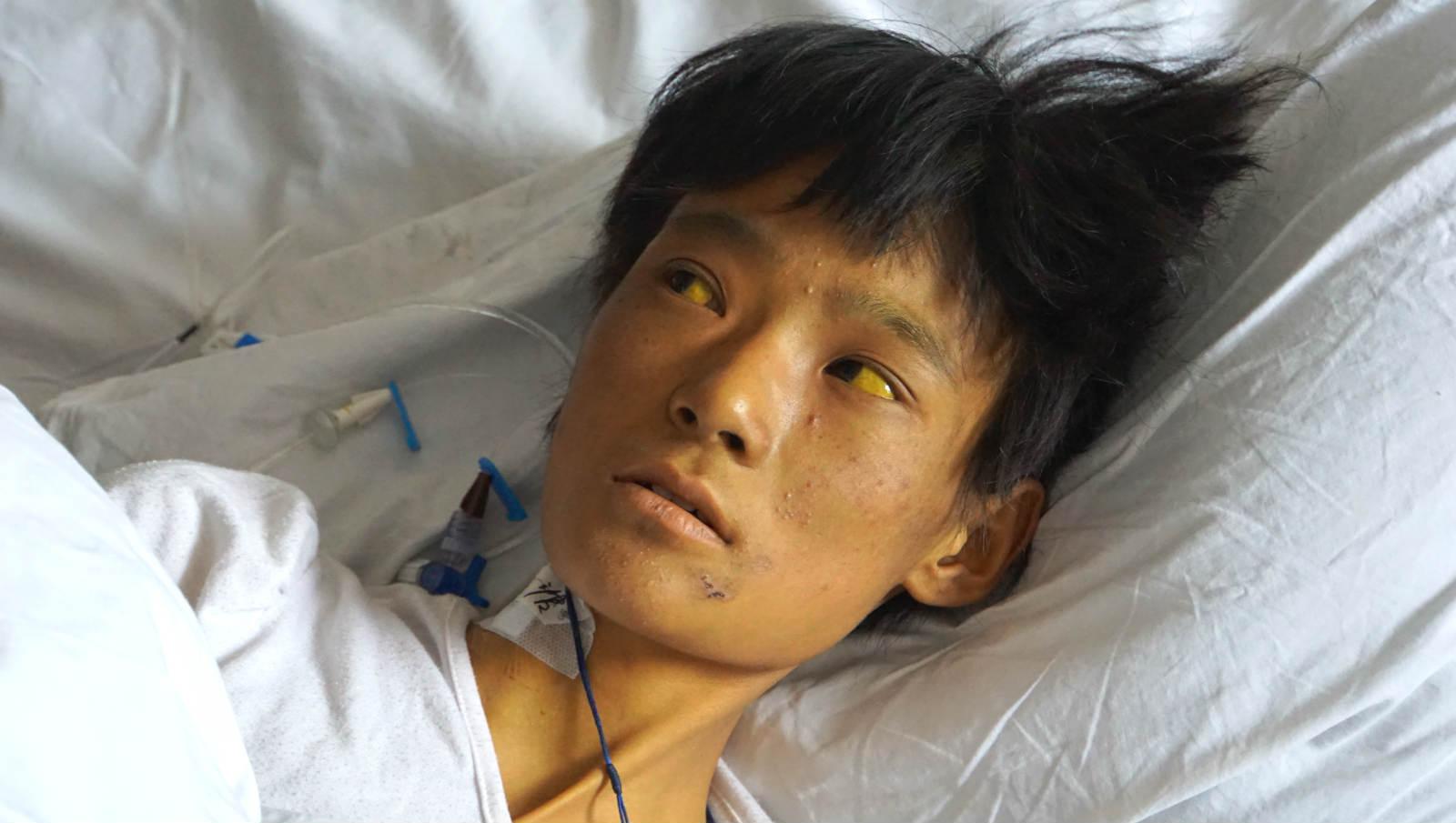 黄河25必死无疑93包虫病之殇四