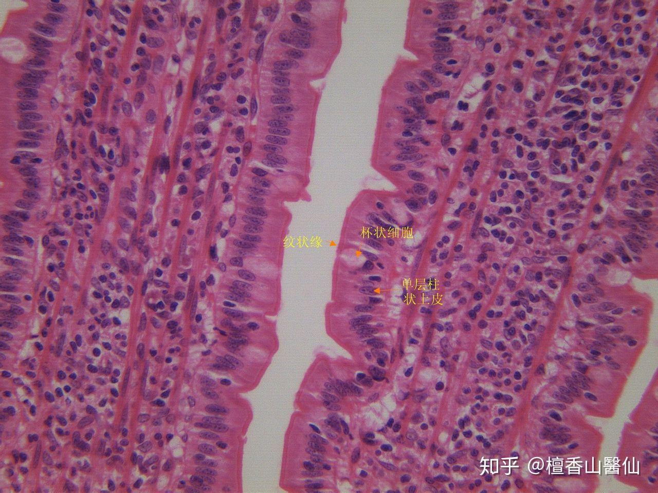 微绒毛表面还有一层厚0.1～0.