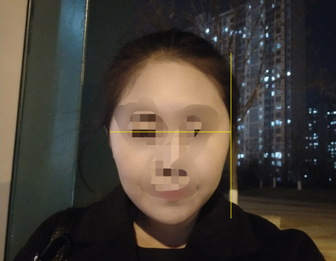 为什么太阳穴两边特别宽大,显得整张脸很臃肿?