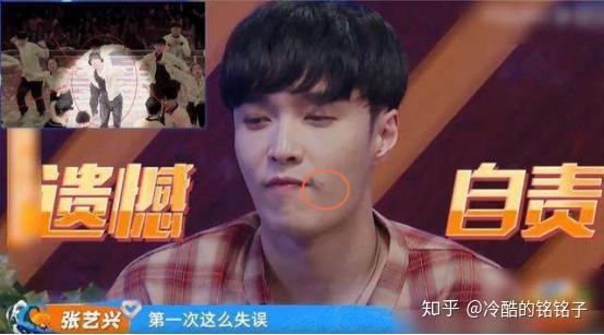 这就是街舞里张艺兴的粉刺这么多年都没祛掉中招的社畜又怎么办