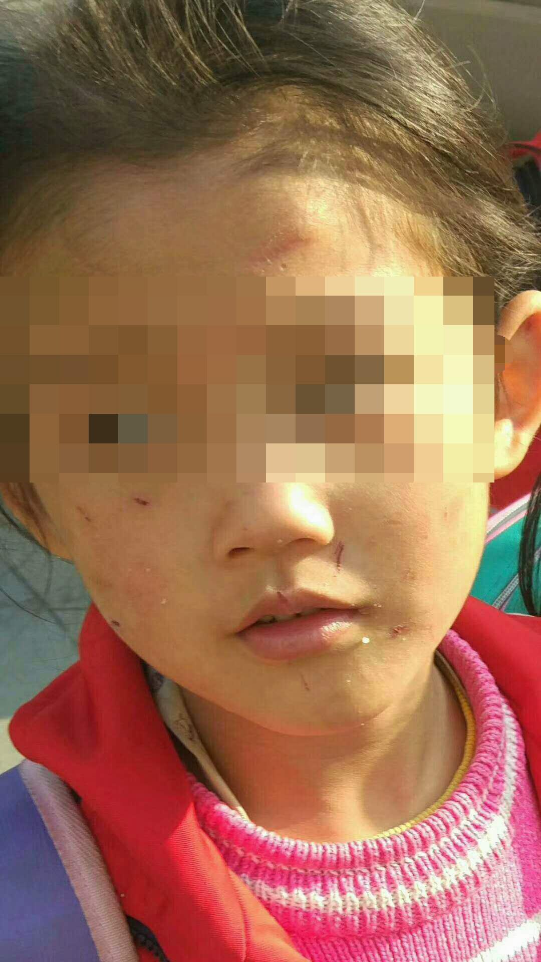 老师求求您不要告诉妈妈否则我回去会被打的更厉害