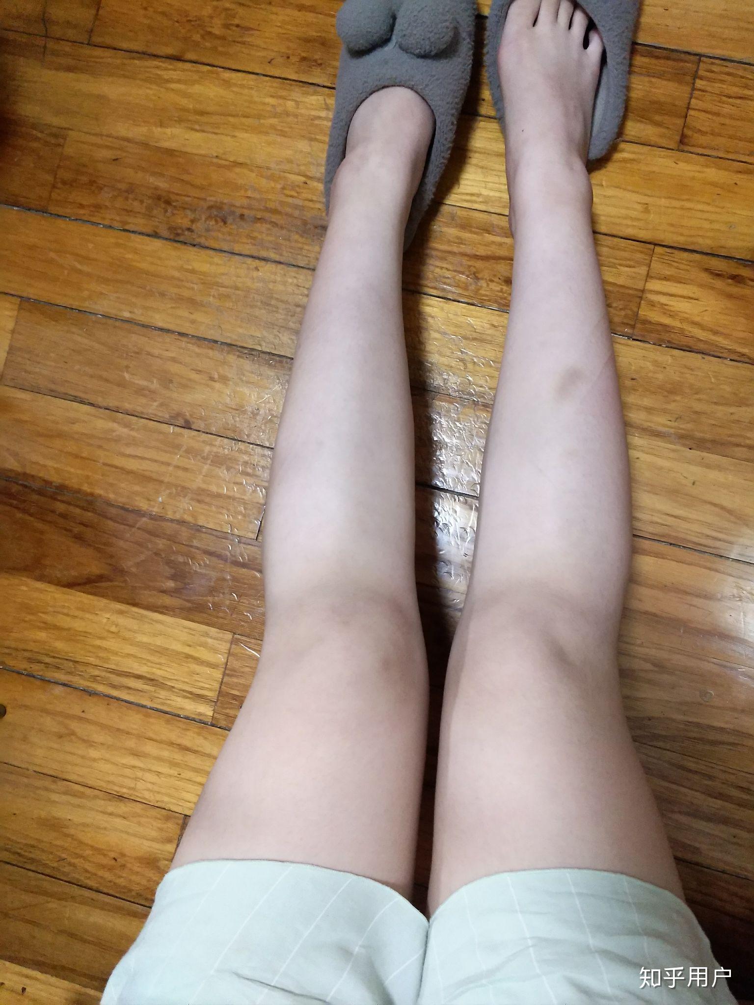 女生腿粗是怎样一种体验