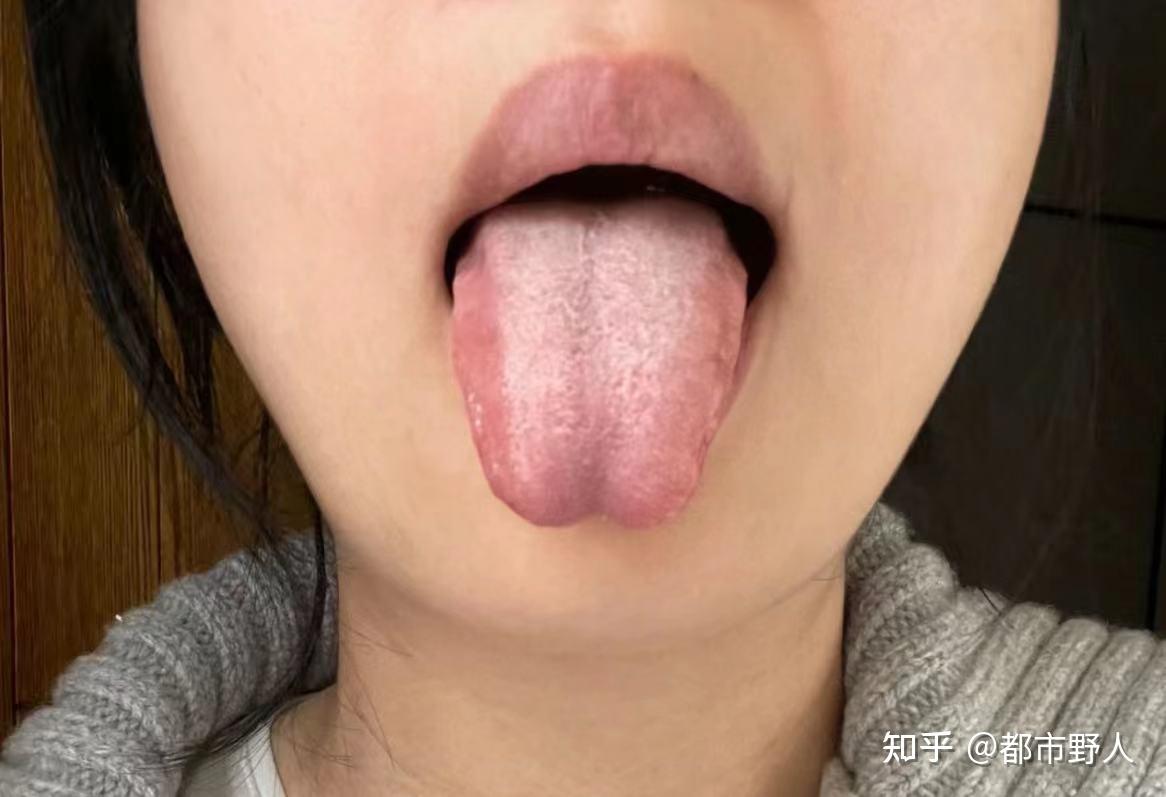 舌苔发白发厚,还有很严重的口臭,要怎么改善?