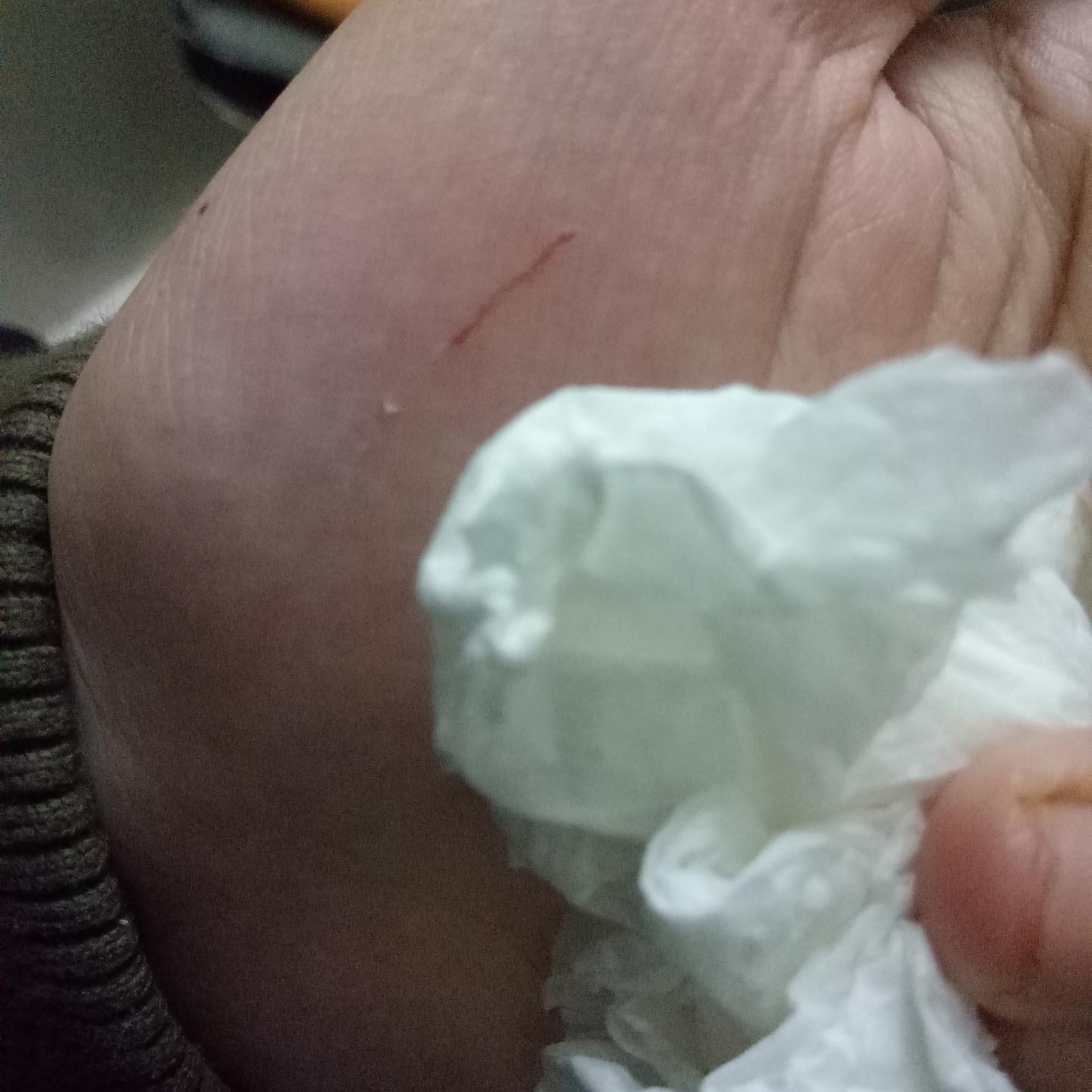 被猫抓伤打疫苗时间 v2-64e3b8576c7c69b5bd288328fa11d6f6_1440w.jpg?source=172ae18b