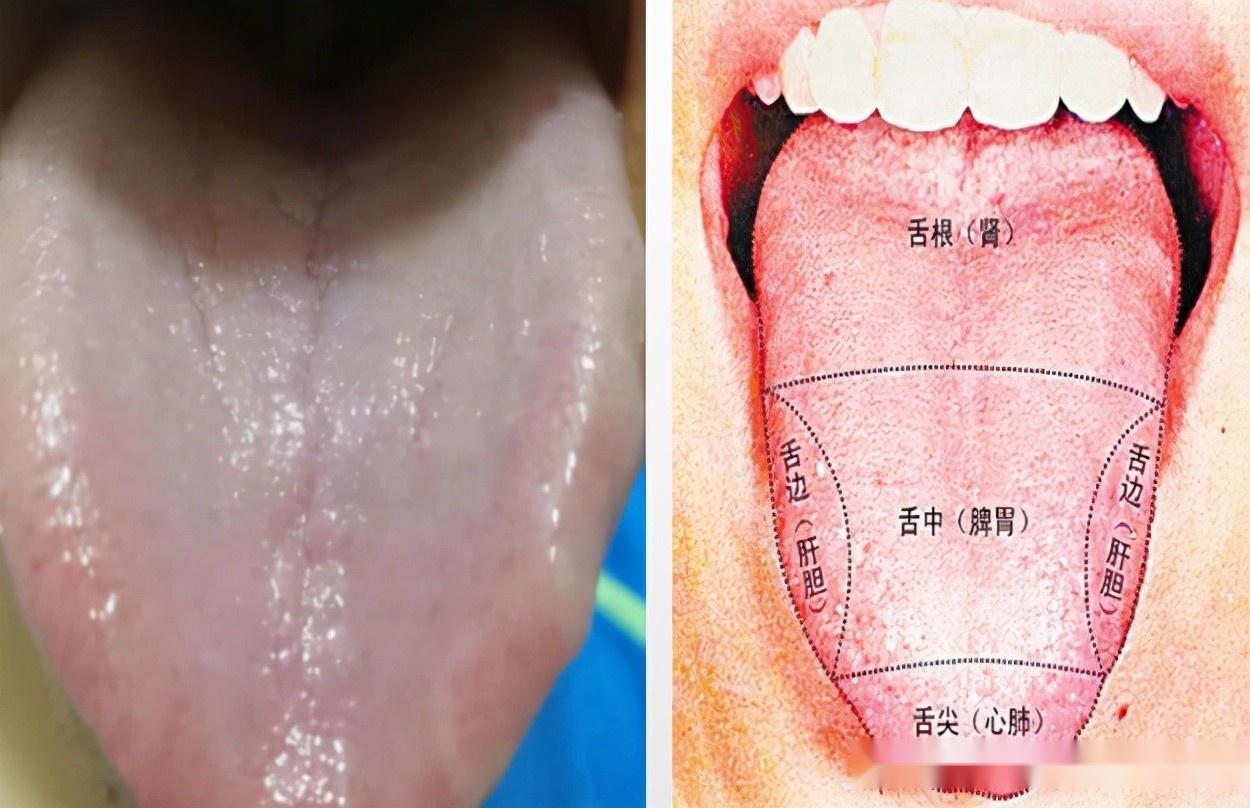 中医讲,舌白缺血、舌红缺水、舌胖缺气!气虚久了,就会阳虚吗? - 知乎