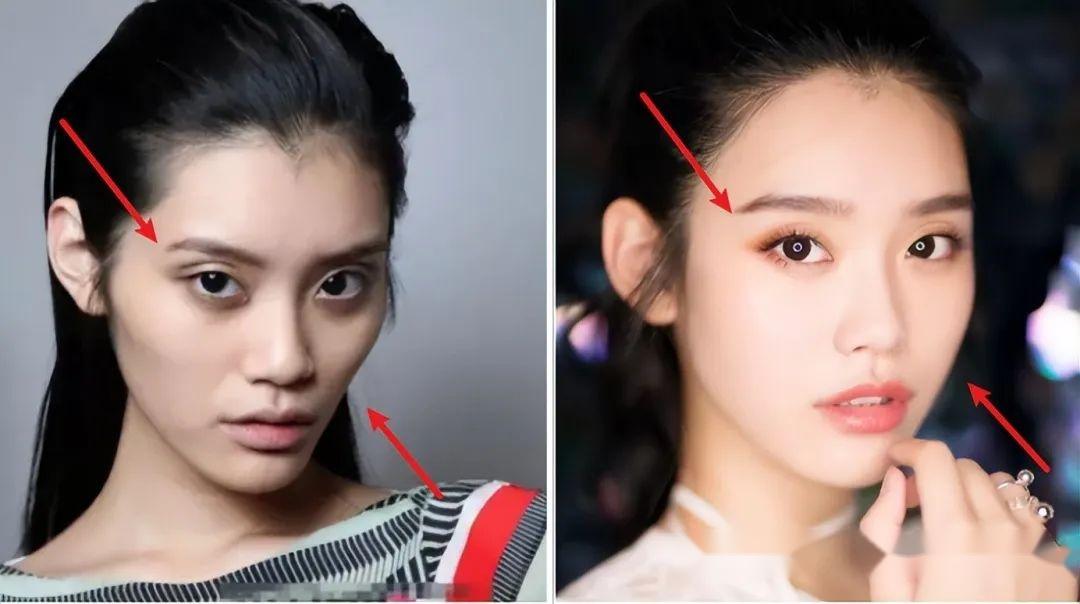 眼窝凹陷才是毁容利器堪称女明星的颜值杀手深邃迷人还是疲惫显老就在