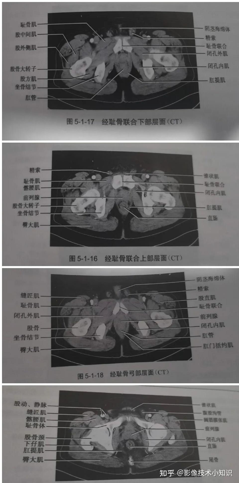 男性生殖系统解剖 - 知乎