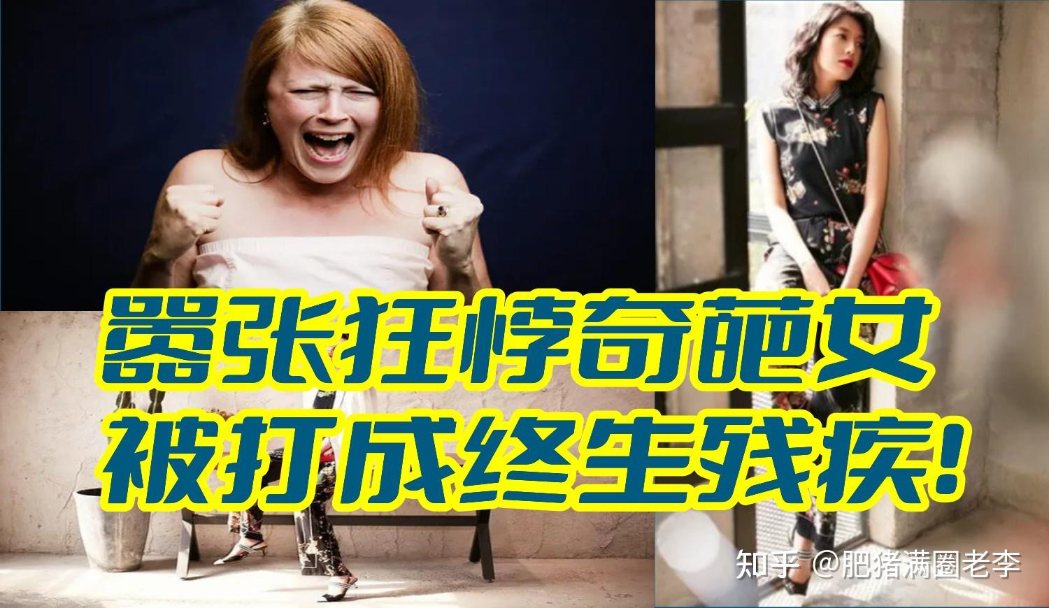 嚣张狂悖奇葩女被打成终生残疾