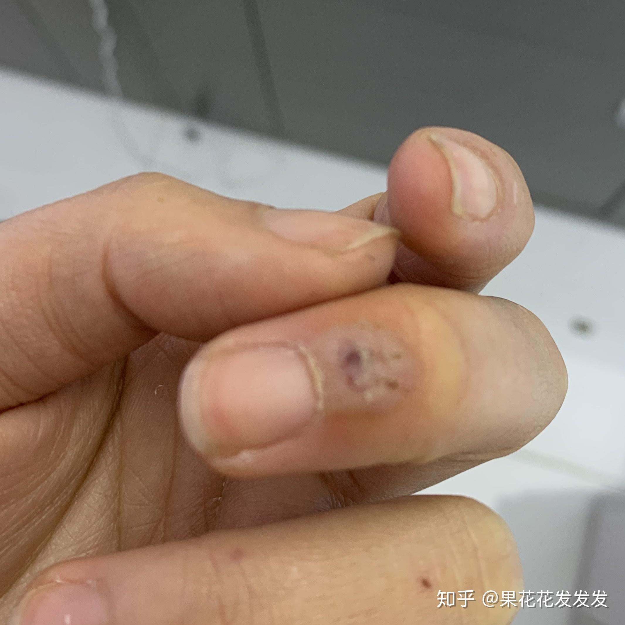 开个帖子记录冷冻休子的过程126