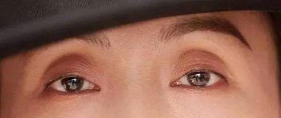 一双眼拯救一张脸?别闹了,你真的适合做双眼皮吗? - 知乎