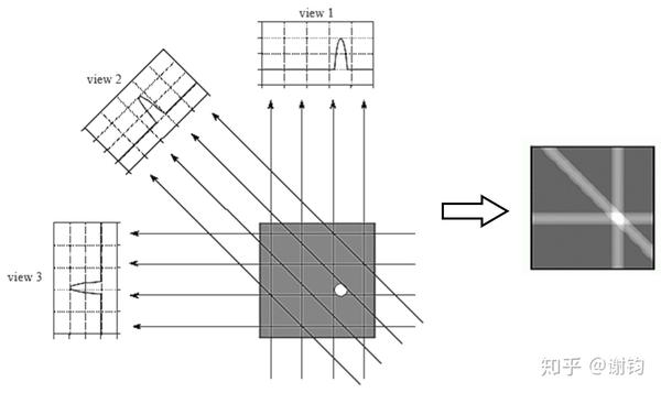 现代医学成像(3)——CT(基本原理与图像重建) - 知乎