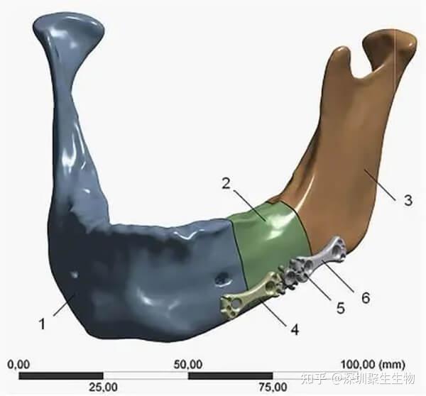 从可降解聚酯粉末到骨修复支架:SLS 3D打印赋能精准医疗 - 知乎