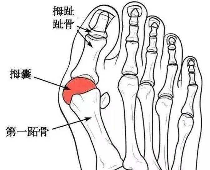 v2-65fa37c7e217d30240b7e519fccdb1ee_1440w.jpg?source=172ae18b