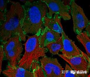 Erythrocyte Membrane Protein Band 4 1 Like 3 Inhibits Osteosarcoma Cell