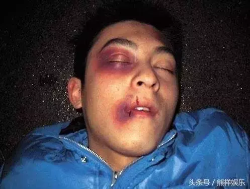 关于视觉锤的延伸思考