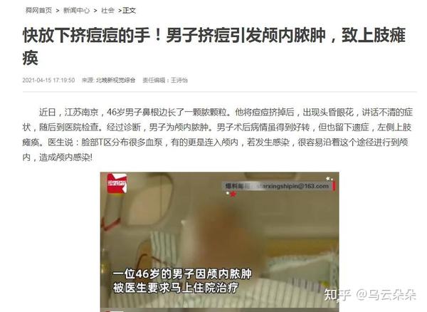 26岁干性皮肤女人如何保养护肤_护肤保养开课啦_开护肤保养