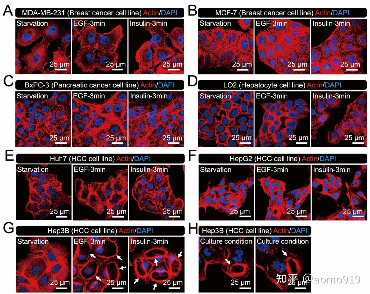 AbMole科研-环形膜褶皱干扰肝细胞癌Hep3B细胞中生长因子诱导的PI3K-AKT通路 - 知乎