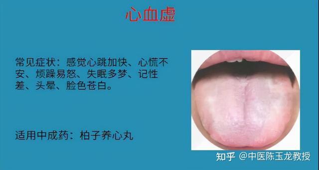 想要改善身体,先来看看自己属于气虚还是血虚吧!血虚症状自测表 - 知乎