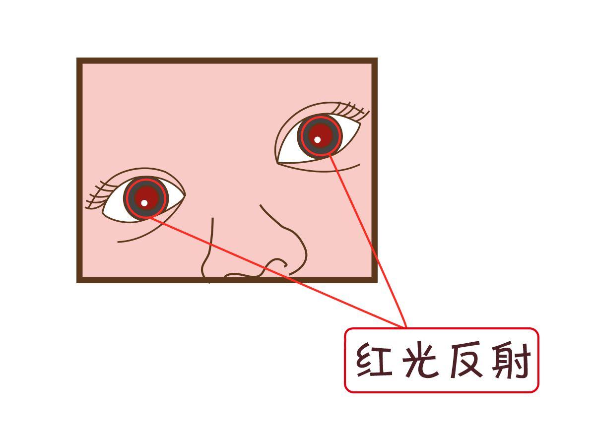 偶然拍下的这张照片,帮她救了孩子一命——白瞳孩子一定要小心这种恶