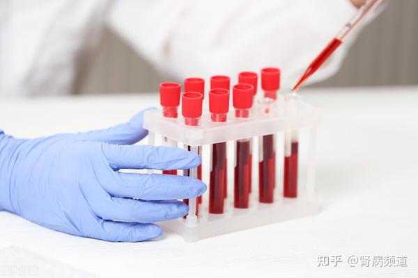 肾病血生化检查全览,再也不愁看不懂化验单 - 知乎