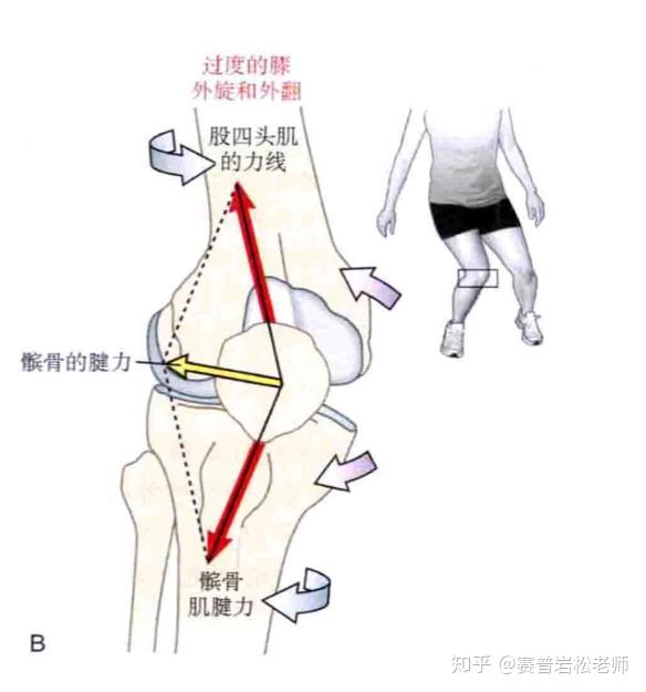 膝关节弱的人能练深蹲吗康复大咖传授预防膝关节损伤秘籍