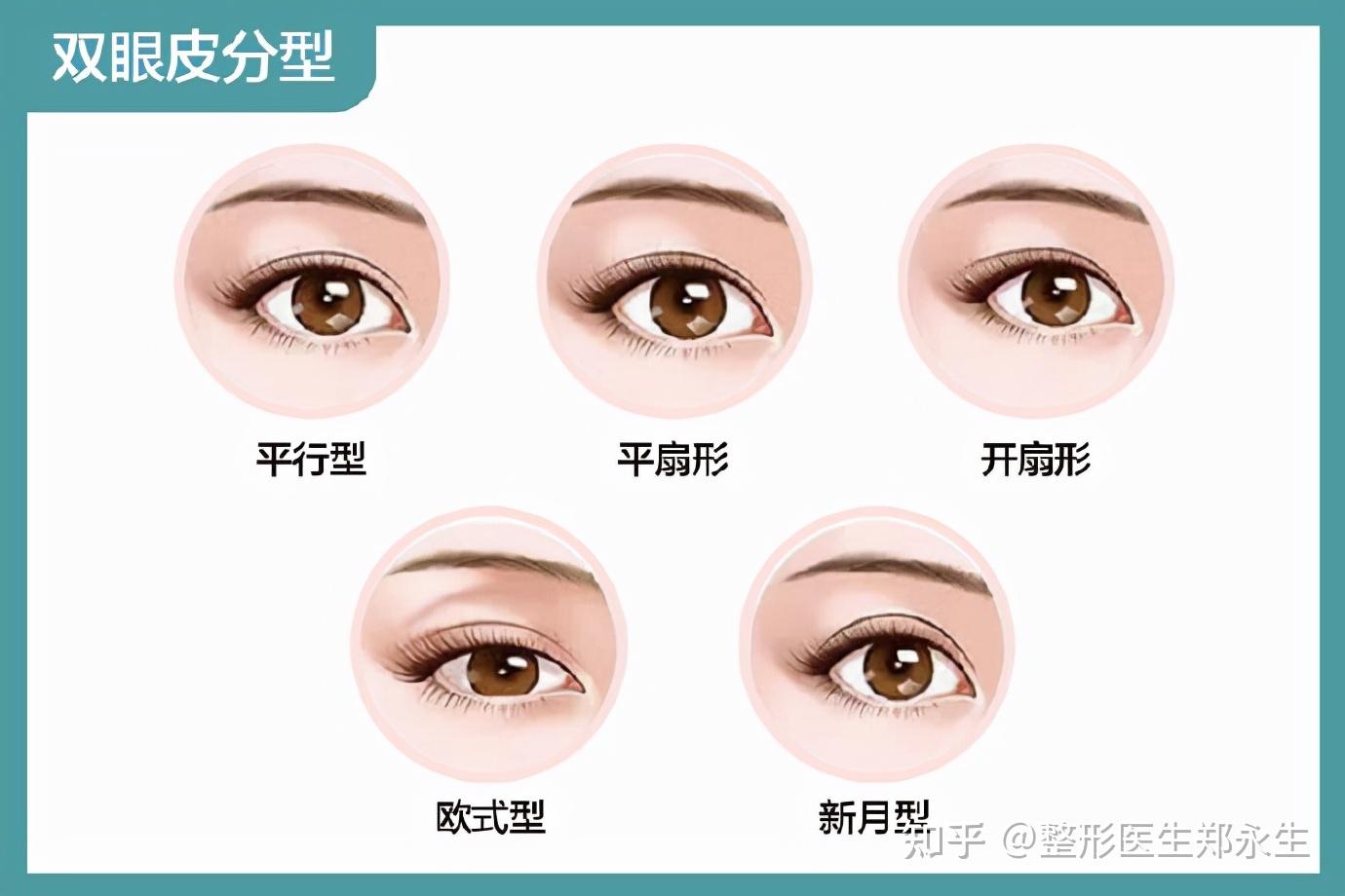 如何确定双眼皮手术方案? - 知乎