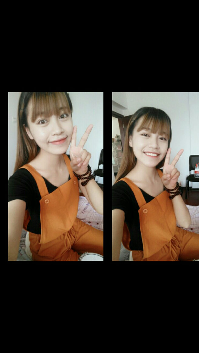 有人知道笑起来嘴角上面的小括号是什么吗 不