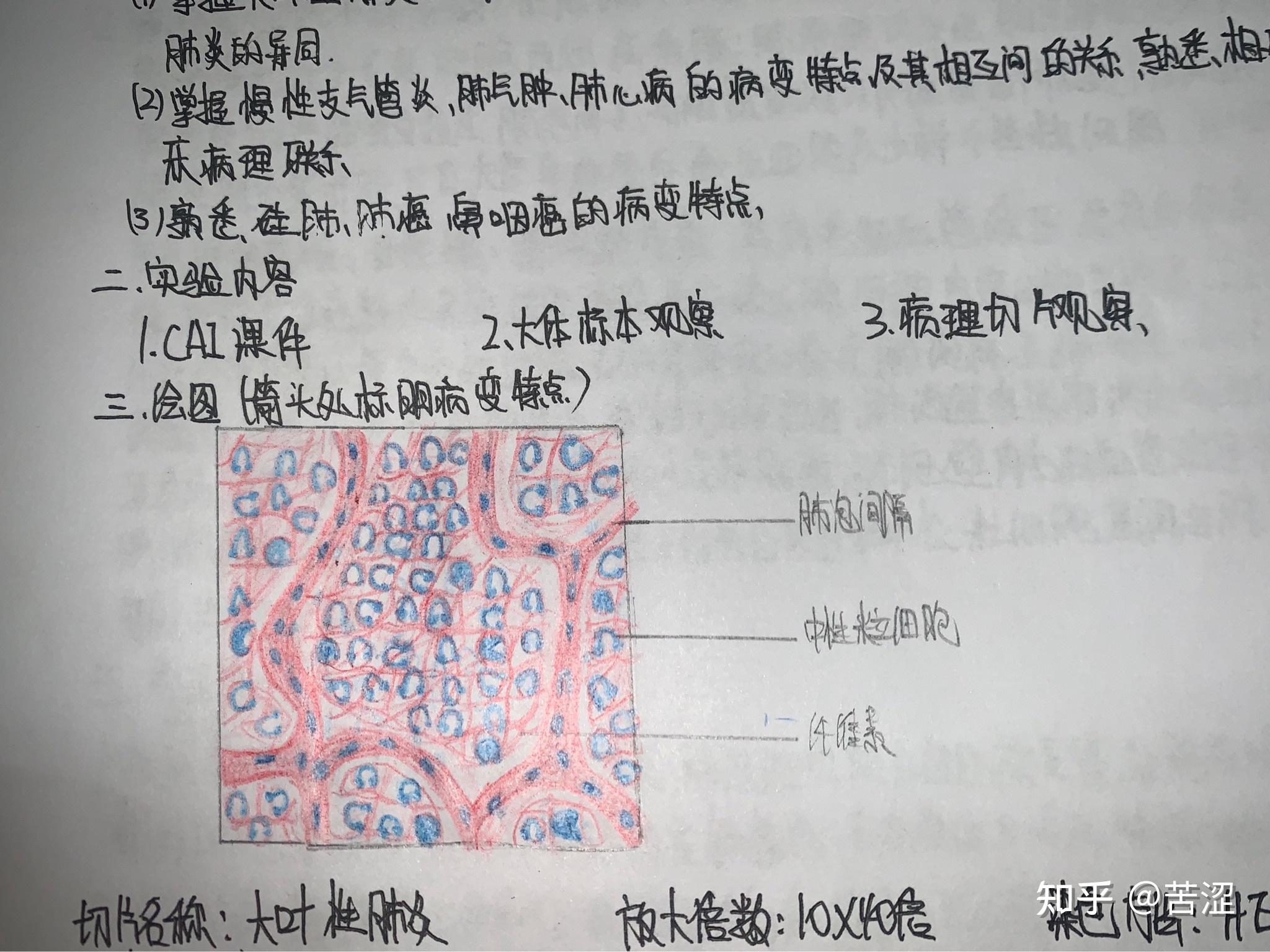 恙虫病立克次体绘图图片