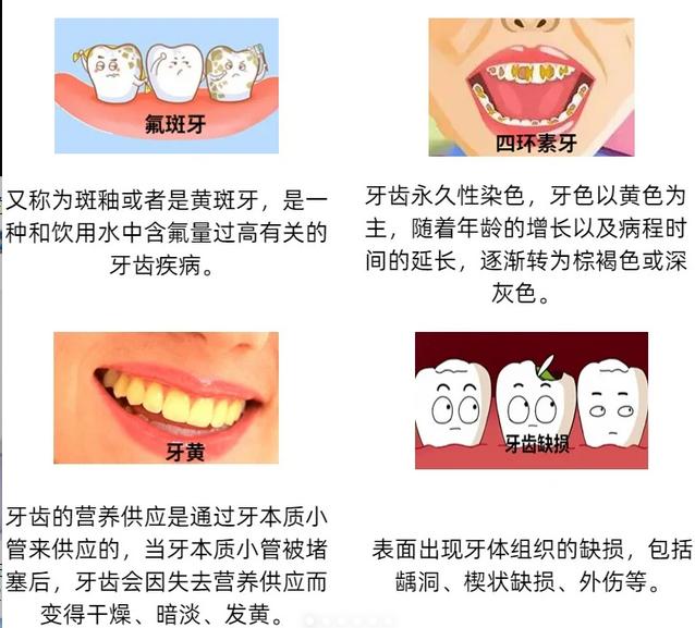 做牙齿贴面伤牙吗?牙冠和牙贴面有什么区别呢?应该怎么选?