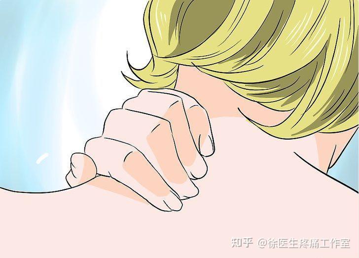 斜方肌拉伤的症状、治疗及康复训练 - 知乎