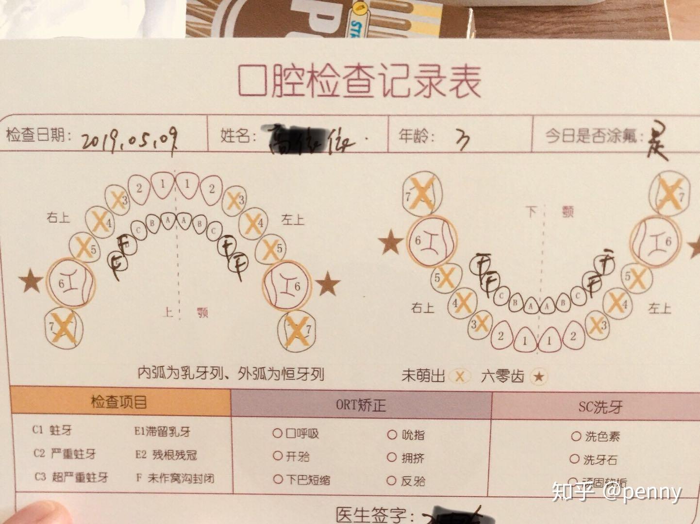 几岁做沟窝封闭牙膏一定要用含氟的吗