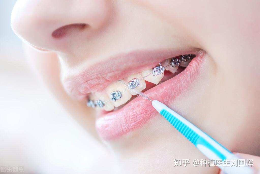 toothbrush怎么翻译__tooth翻译成英文