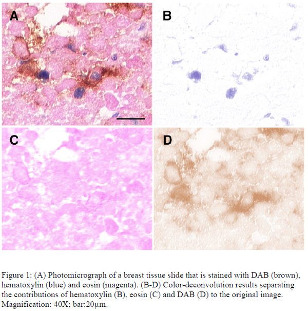 Color Deconvolution - 知乎