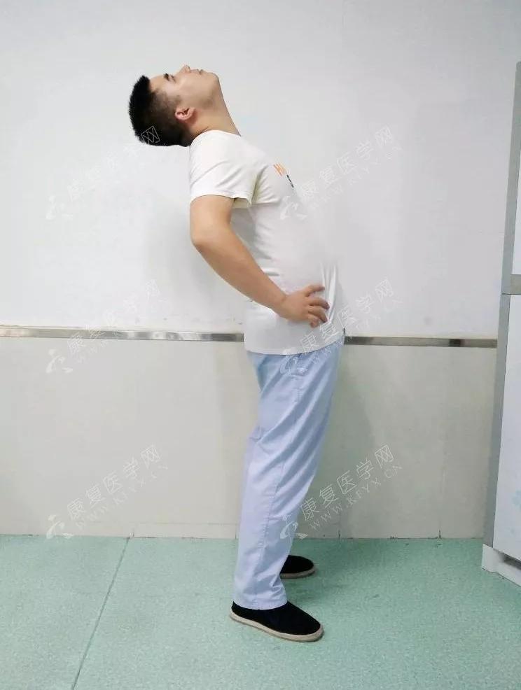 如何通过姿势评估前表线和筋膜问题？（附手法治疗） - 知乎