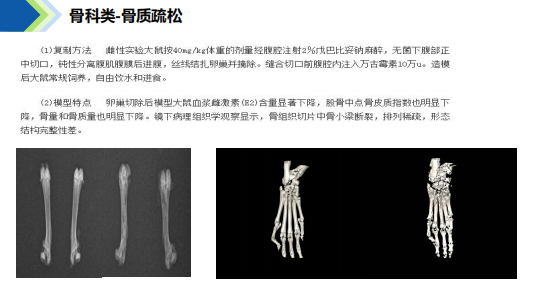 骨质疏松模型 知乎 骨质疏松模型 知乎
