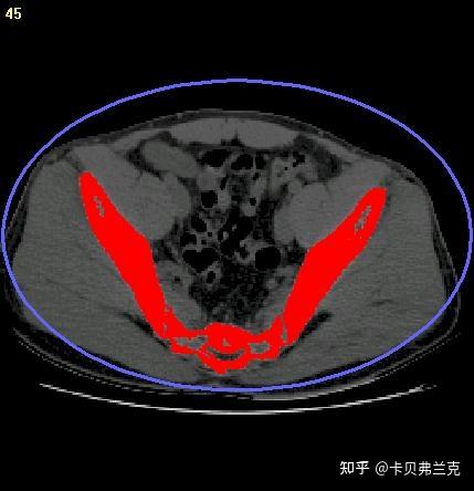 3D-Doctor:开启医学影像的三维新视界 - 知乎