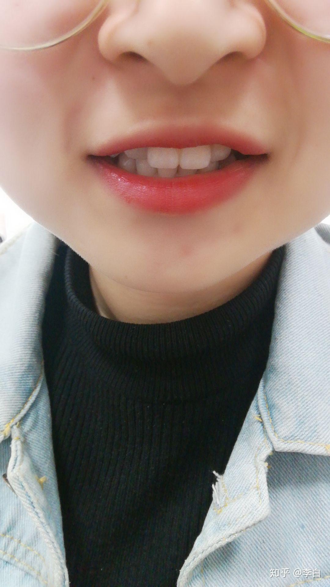 嘴巴太小是怎样的体验? - 知乎