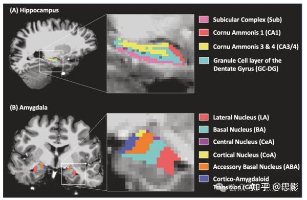 重性抑郁症患者海马与杏仁核亚区连接组层级的改变 - 知乎