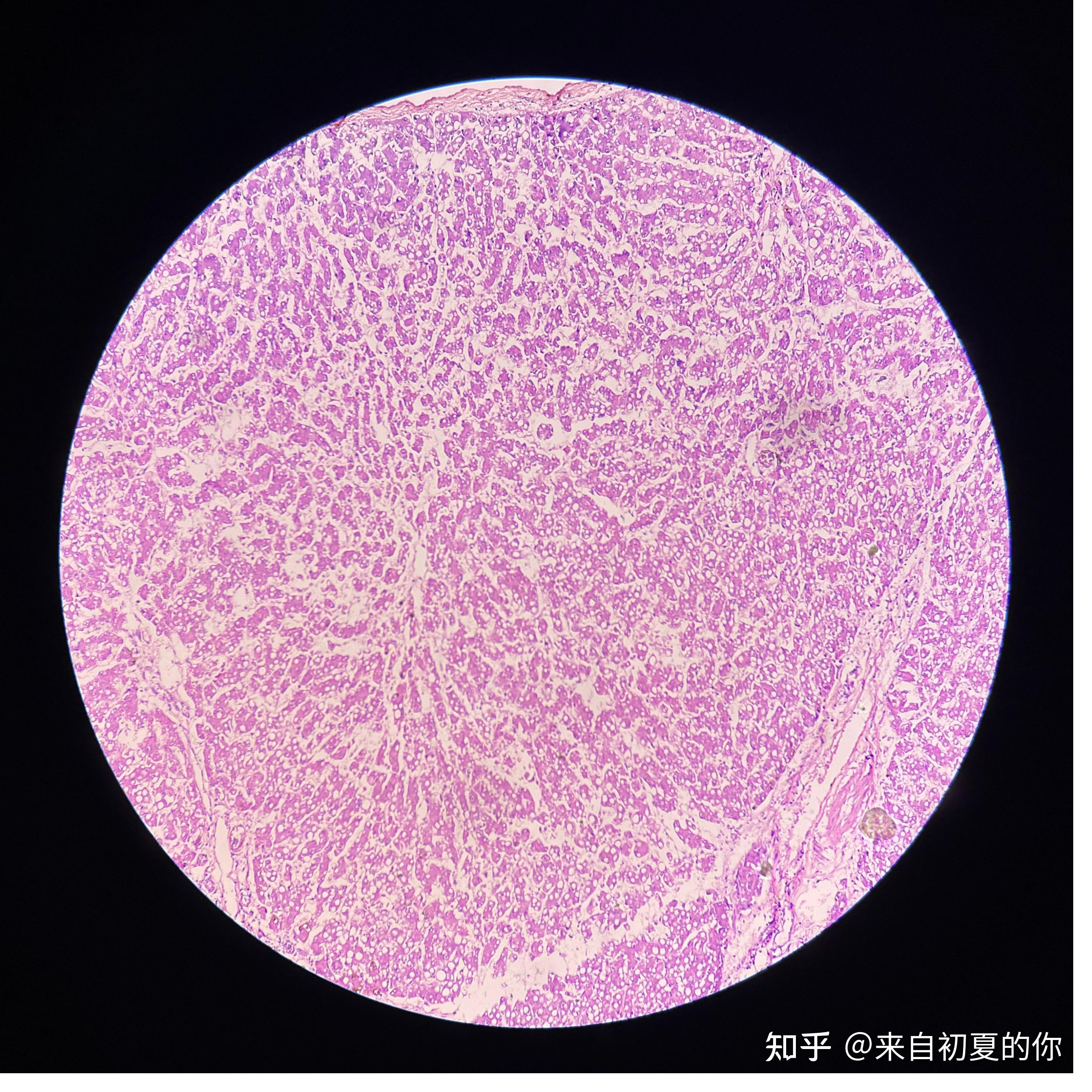 病理学切片图 - 知乎