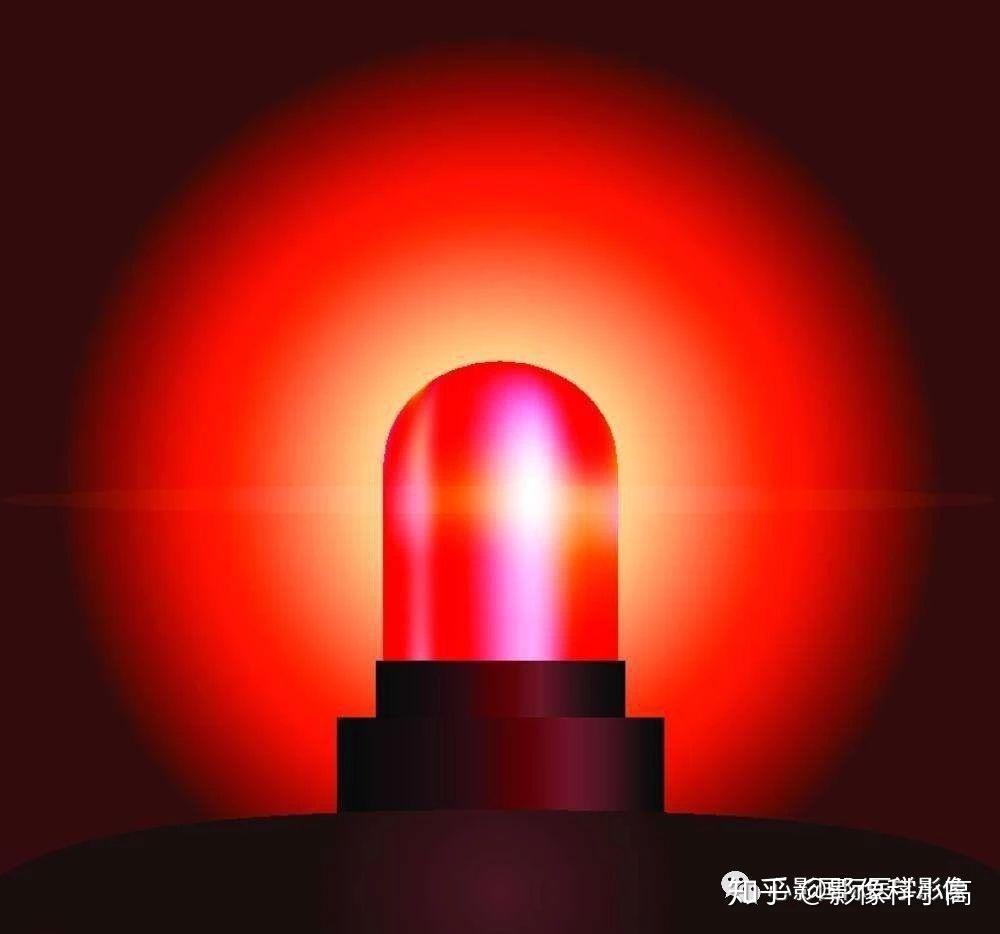 心源性水肿下肢水肿可能是心脏病变的危险警报