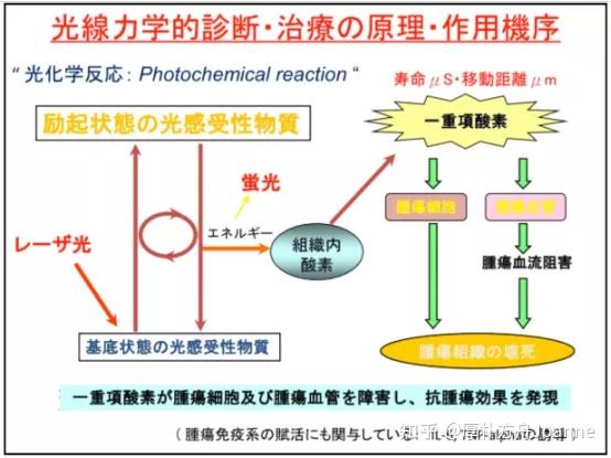 光动力疗法：让癌细胞“见光死”的微创治疗方法，治疗肺癌、恶性脑肿瘤效果显著 - 知乎
