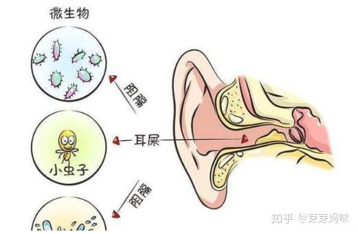 外耳道异物