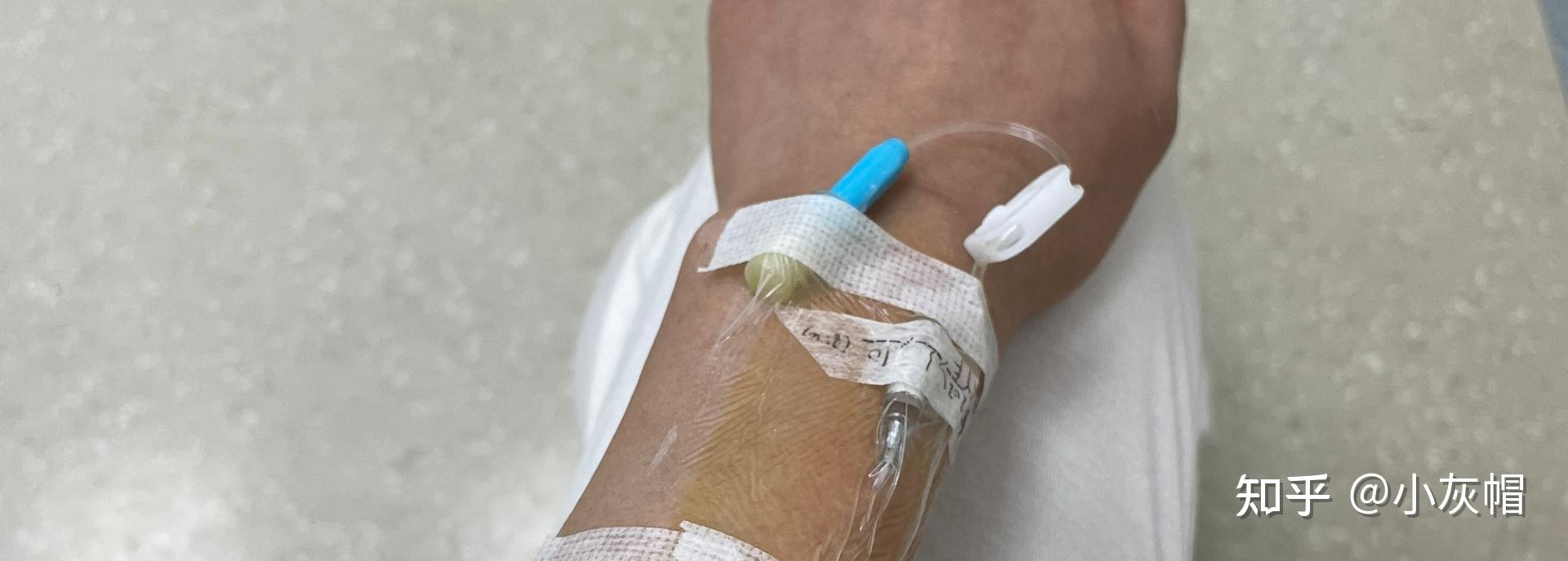 没多久给我打留置针的男护士找来一个男护工,带我去门诊大楼做加强ct