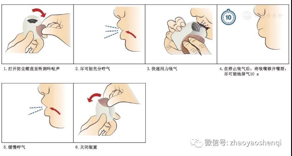 慢阻肺的吸入治疗:吸入药物的选择及吸入装置的正确使用